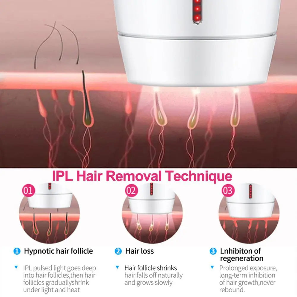 Home laser hair removal instrument Kore Shopping