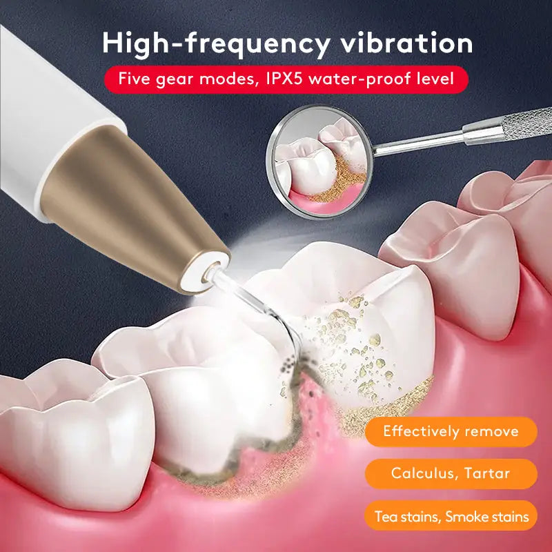 Teeth-Grinding Ultrasonic Tooth Cleaner, Stain & Tartar Remover, Teeth Whitening Device, Oral Care Instrument Kore Shopping